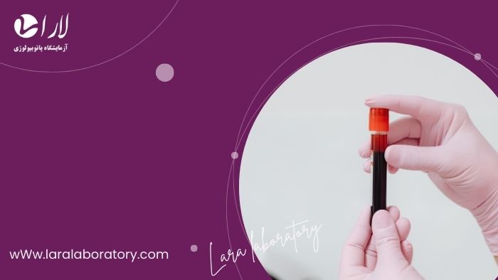 ۵ اشتباه رایج که باعث اشتباه شدن جواب آزمایش می‌شود