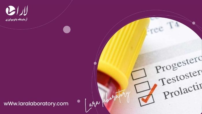 شرایط قبل از آزمایش پرولاکتین (Prolactin) 