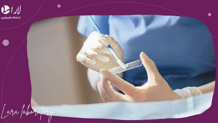 آیا HPV با بیمه تکمیلی قابل انجام است؟