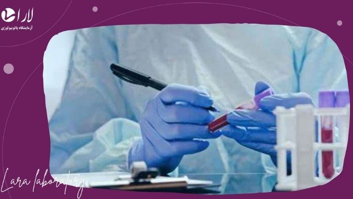 شرایط قبل از آزمایش