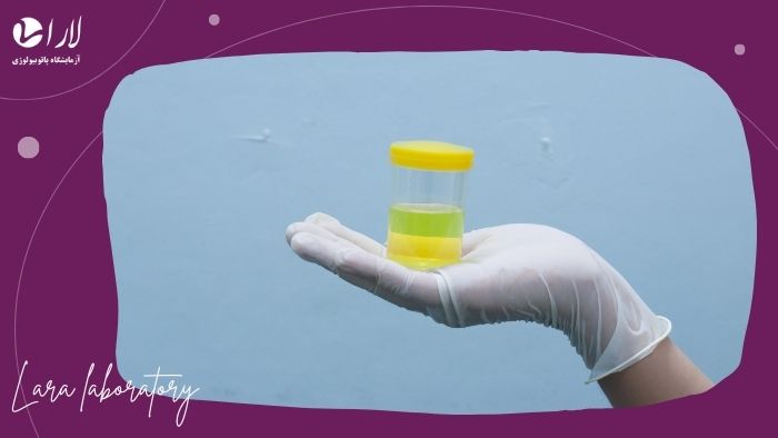 آمادگیهای مراحل آزمایش آمادگیهای مراحل آزمایش