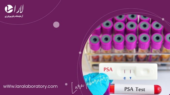 آزمایش PSA  برای مردان چه زمانی لازم است انجام شود؟