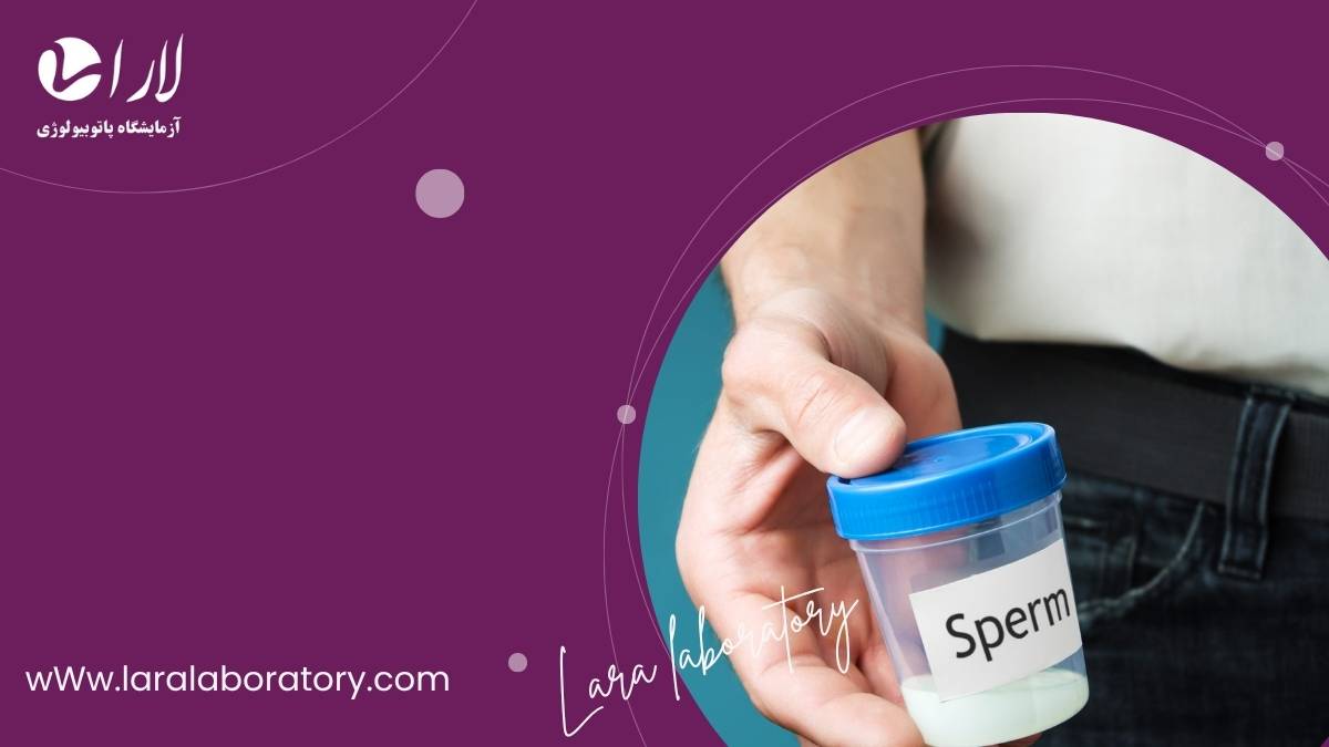 آزمایش اسپرم در شهرری در بهترین و مجهزترین آزمایشگاه آزمایش اسپرم در شهرری در بهترین و مجهزترین آزمایشگاه