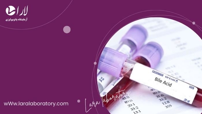 آزمایش بایل اسید در بارداری چیست و در تهران کجا انجام می شود؟