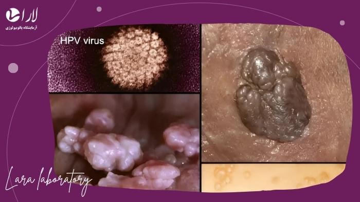 چه زمانی باید تست HPV در مردان انجام شود؟