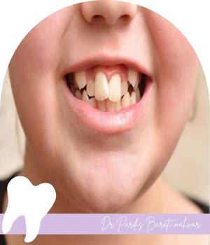 نشانه‌هایی که والدین نباید نادیده بگیرند