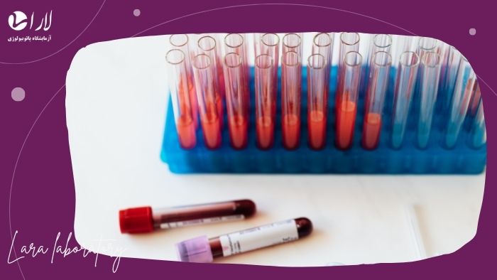 توصیه‌هایی برای افزایش دقت آزمایش تیروئید