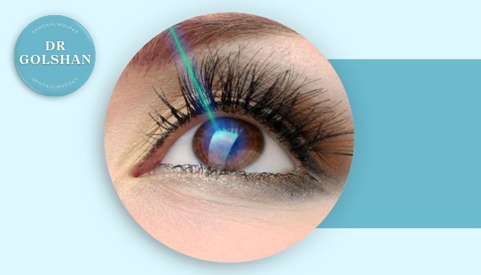 حداقل نمره چشم برای عمل لیزیک چقدر باید باشد؟