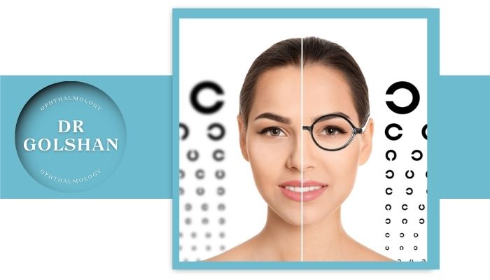 حداقل نمره چشم برای لیزیک