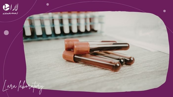 راه های افزایش دقت آزمایش راه های افزایش دقت آزمایش