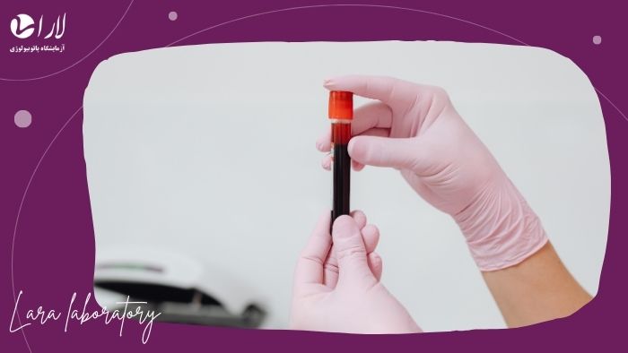 زمان مناسب انجام آزمایشات