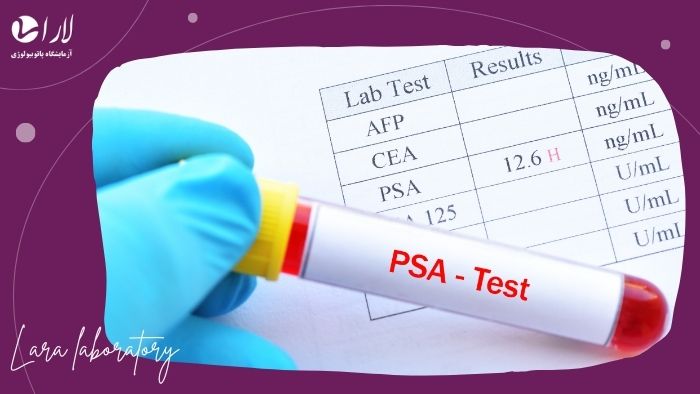 ضرورت انجام آزمایش ضرورت انجام آزمایش