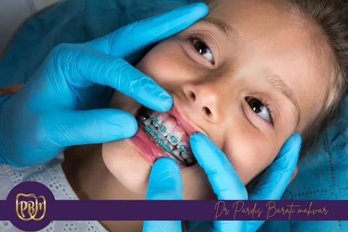 عواقب تأخیر در شروع درمان ارتودنسی