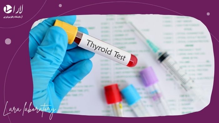 عوامل شایع اشتباه در نتیجه آزمایش تیروئید