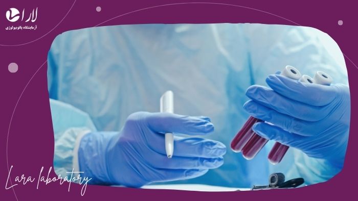 عوامل مؤثر بر نتیجه عوامل مؤثر بر نتیجه