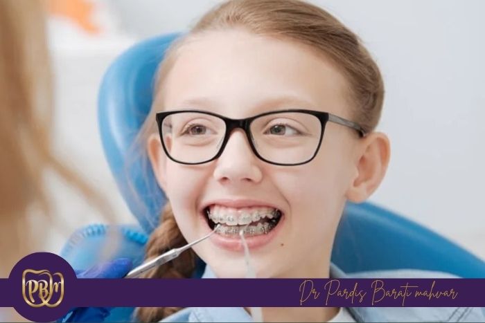 مزایای شروع ارتودنسی در سنین مناسب