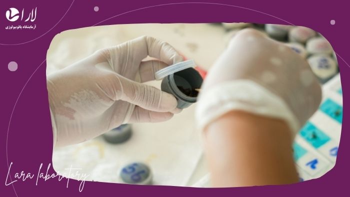 کدام رنگ مدفوع خطرناک است؟