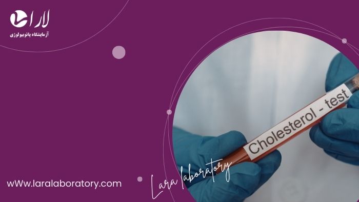 کلسترول بالا را چطور در آزمایش خون تشخیص می‌دهند؟